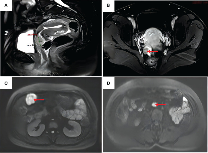 Figure 2