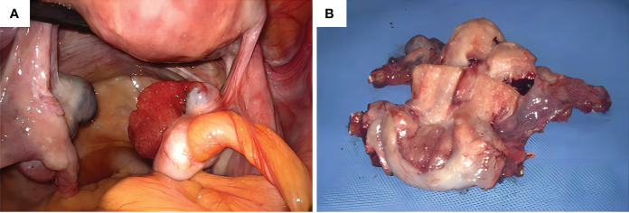 Figure 4
