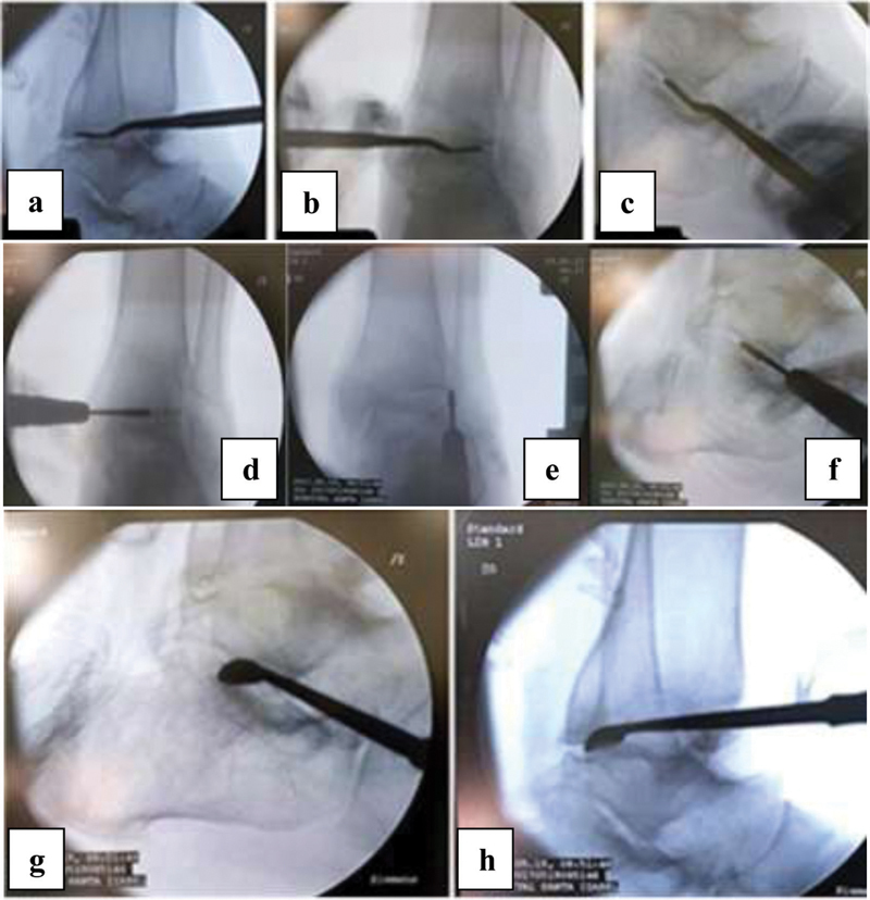 Fig. 2