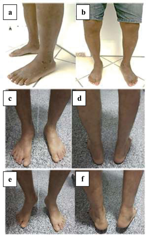 Fig. 4