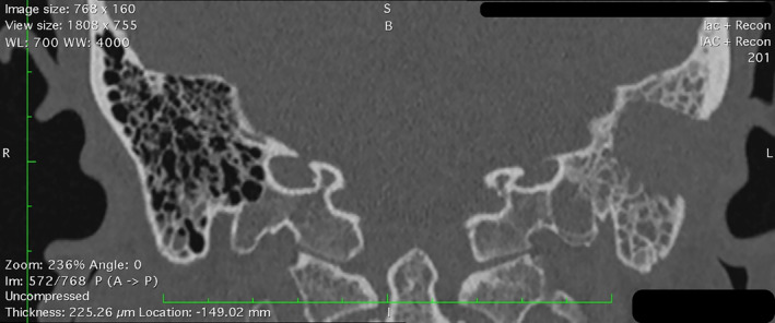 FIGURE 3