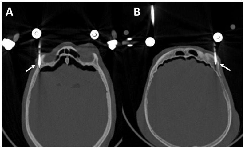 Figure 9