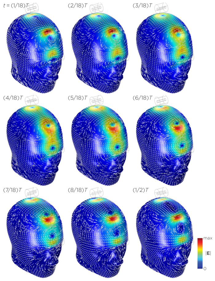Figure 11