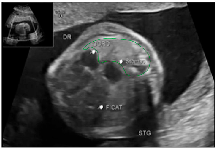 Figure 2