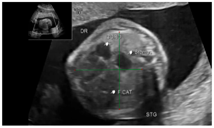Figure 4
