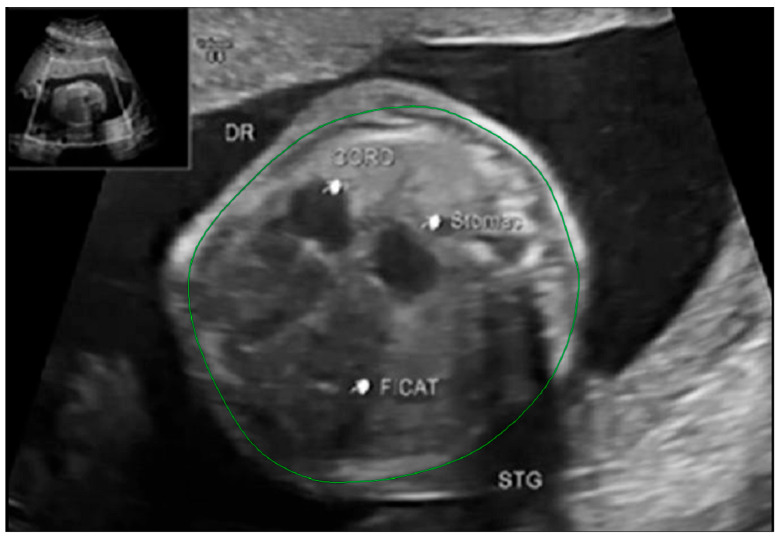 Figure 6