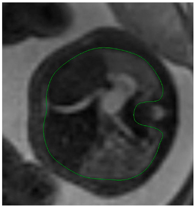 Figure 7