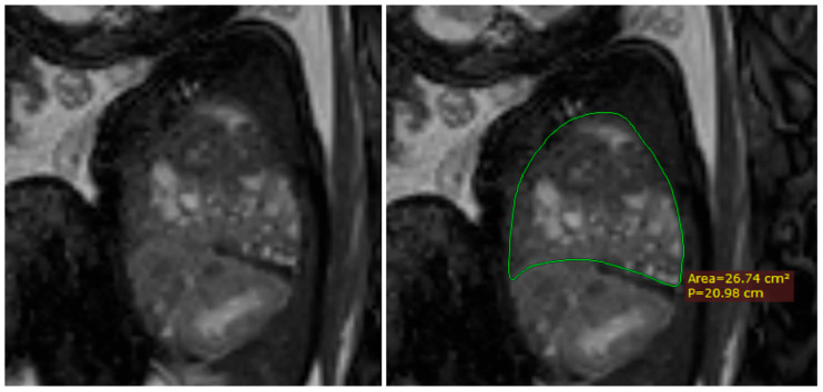 Figure 9