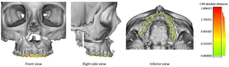 Figure 11