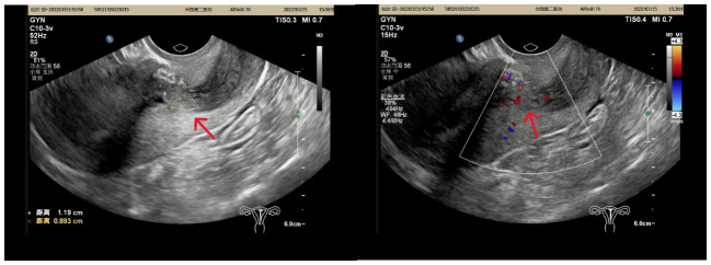 Figure 1