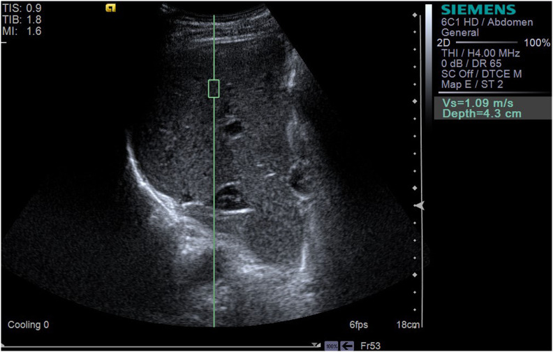 Figure 3