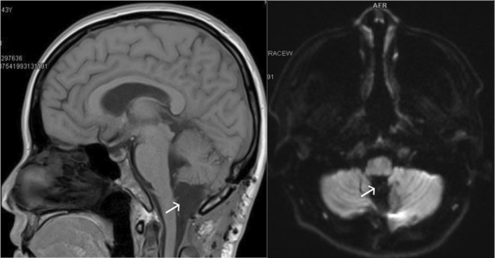 FIGURE 3