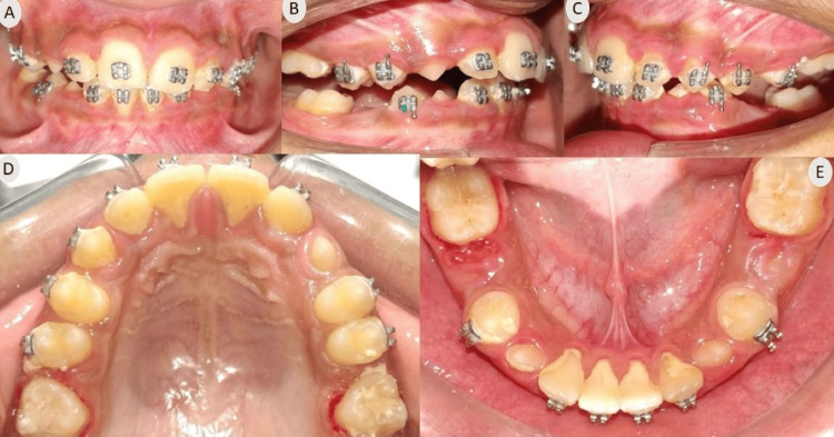 Figure 10