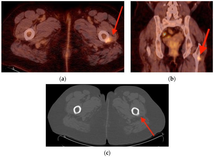 Figure 9