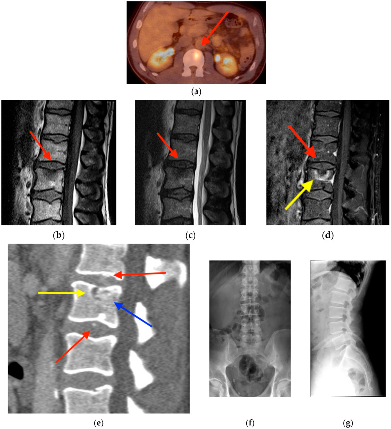 Figure 14