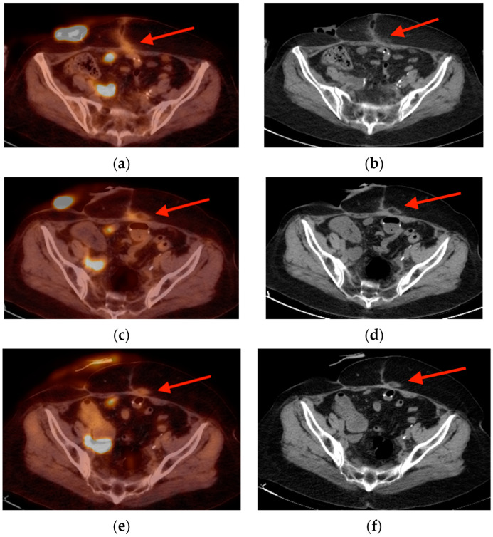 Figure 15