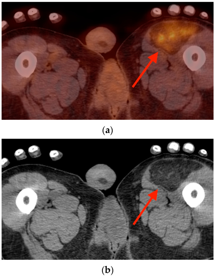 Figure 17