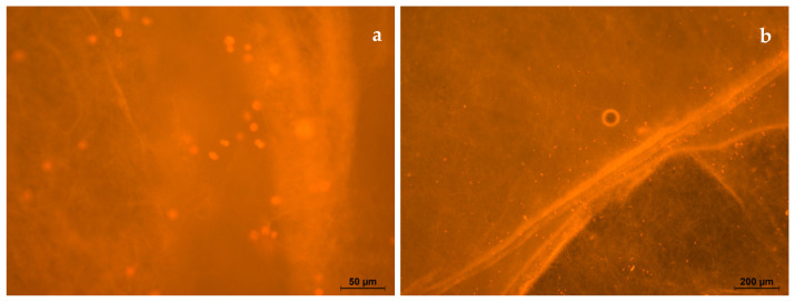 Figure 18
