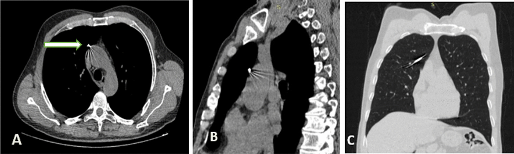 Figure 2