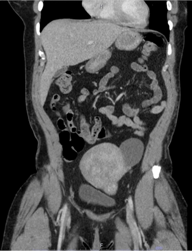 Figure 9