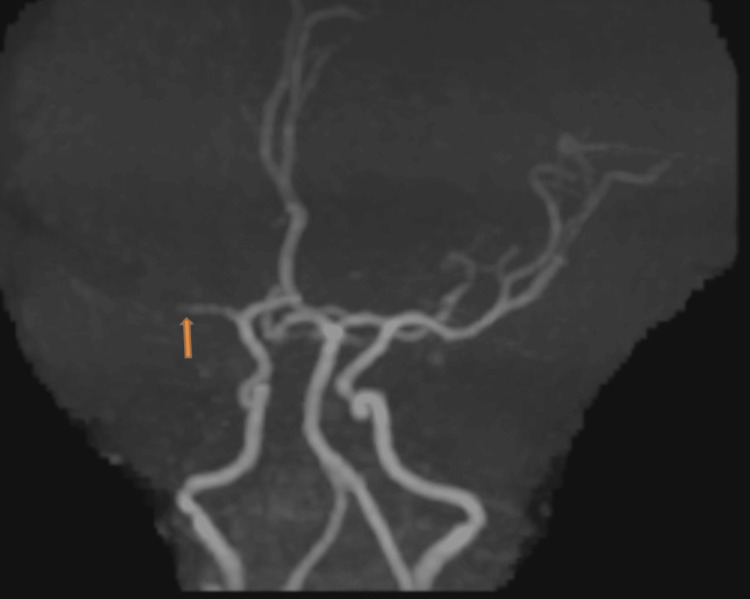 Figure 8
