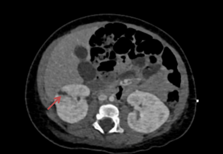 Figure 9