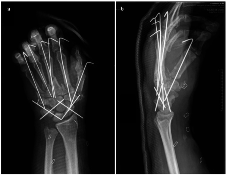 Figure 4