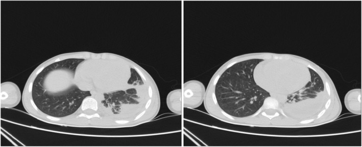 FIGURE 2