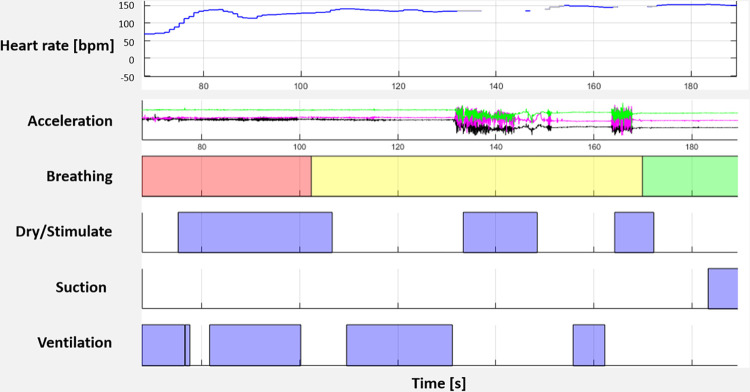 Fig 2