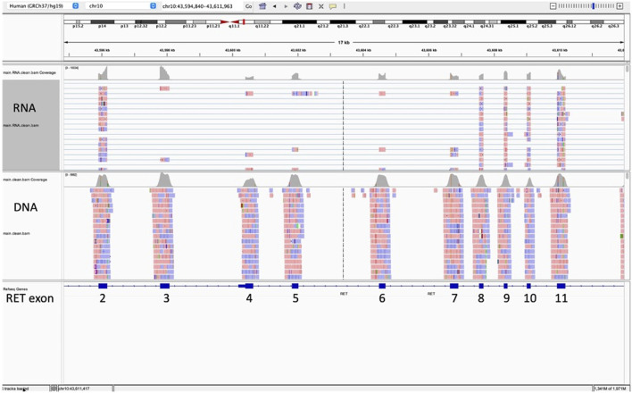 FIGURE 1