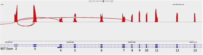 FIGURE 2