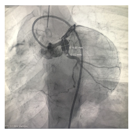 Figure 4