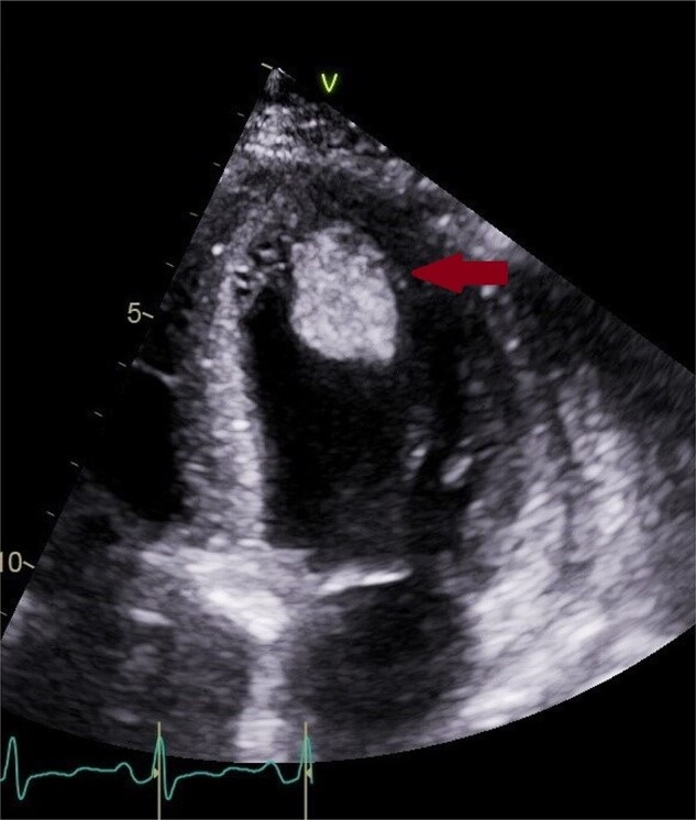 Figure 1