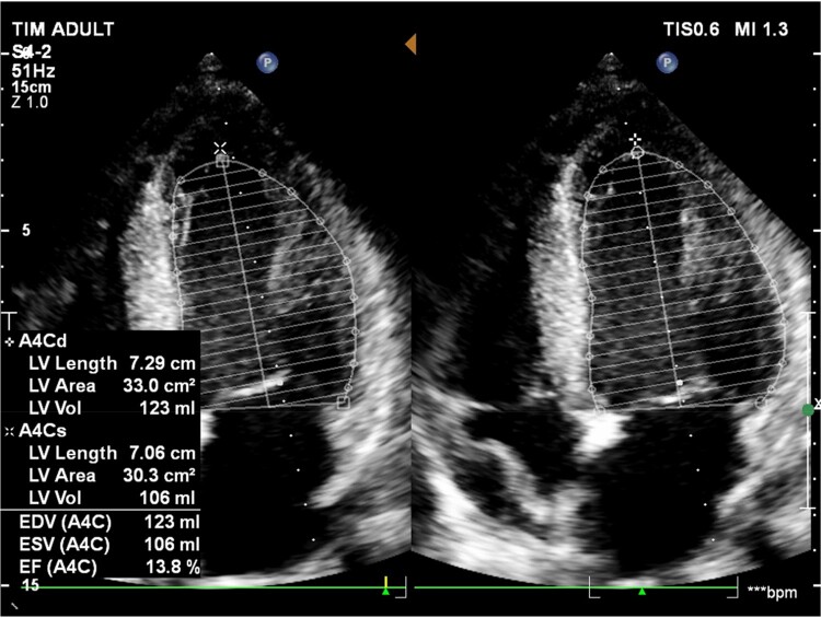 Figure 2