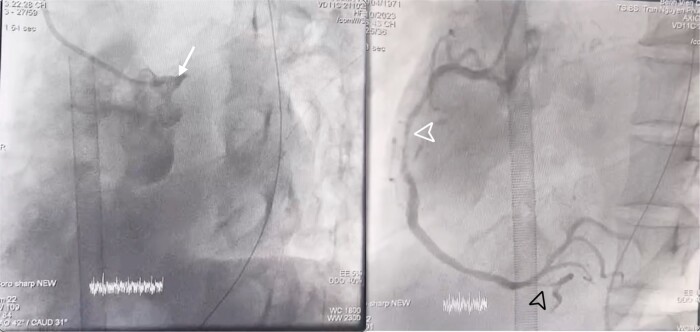 Figure 3