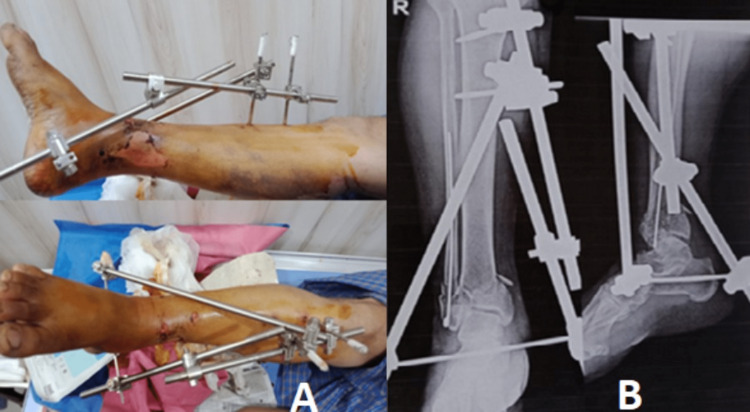 Figure 2