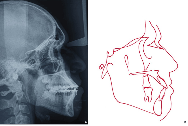 Figure 9
