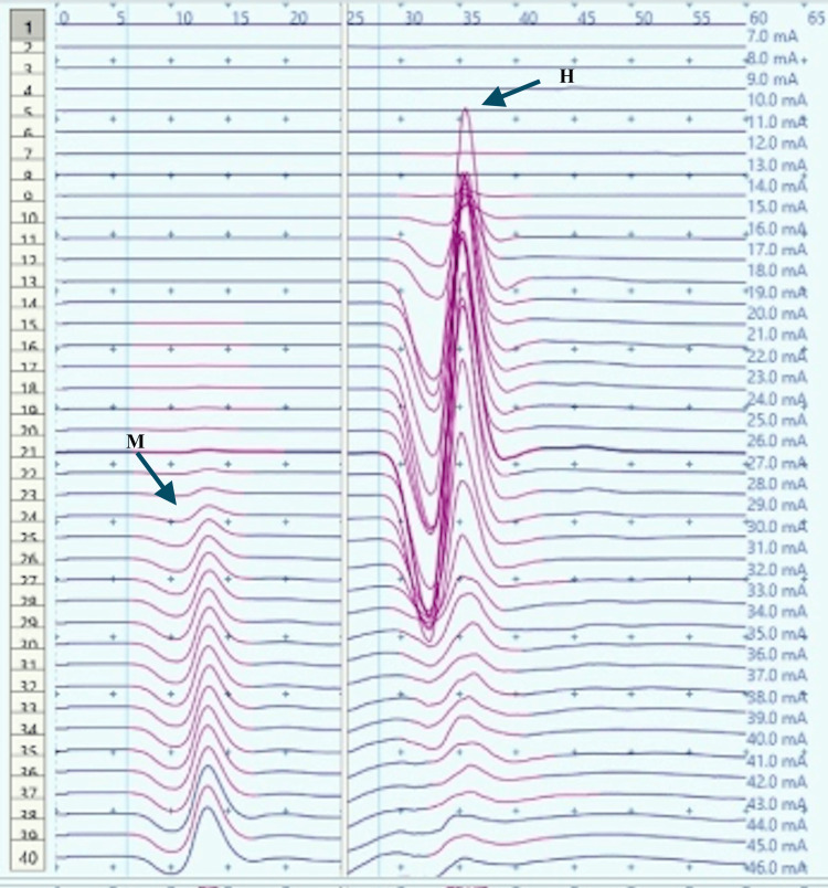Figure 8