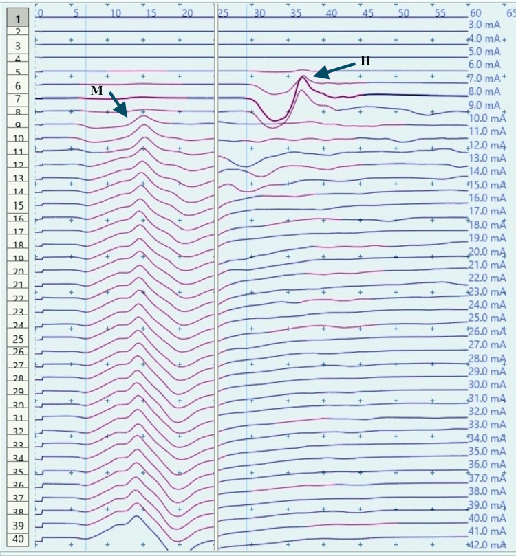 Figure 10