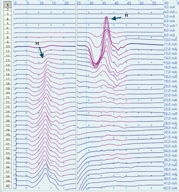 Figure 12