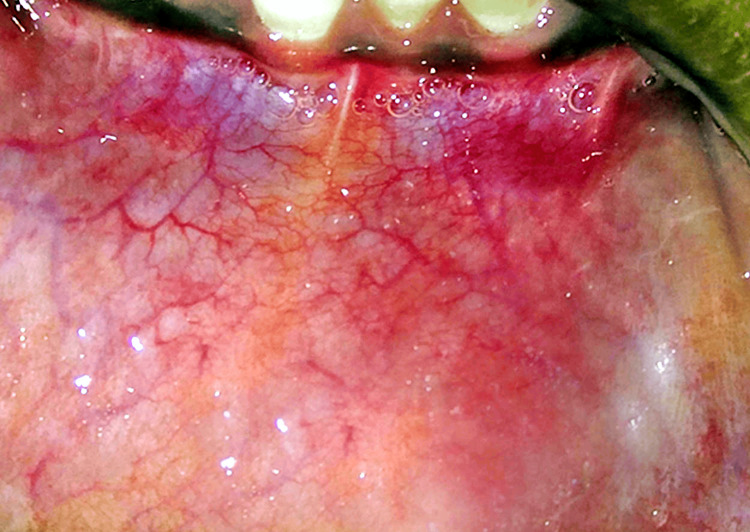 Figure 10