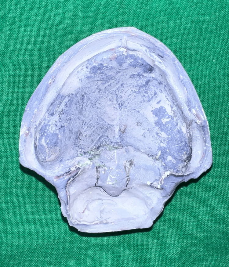 Figure 11