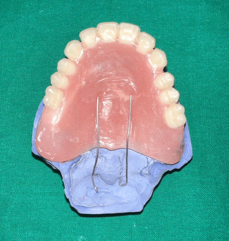 Figure 12
