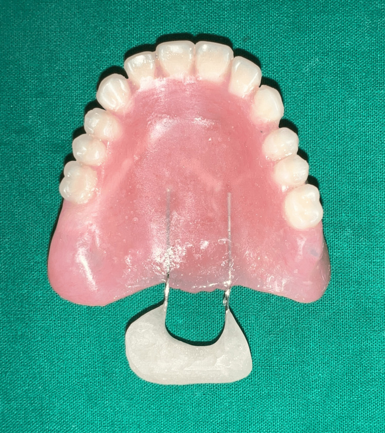 Figure 13