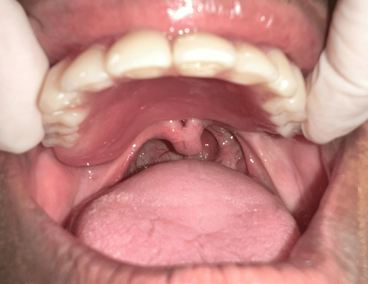 Figure 14