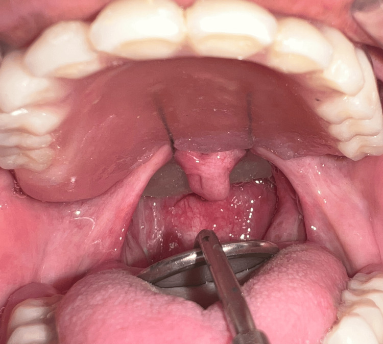 Figure 15