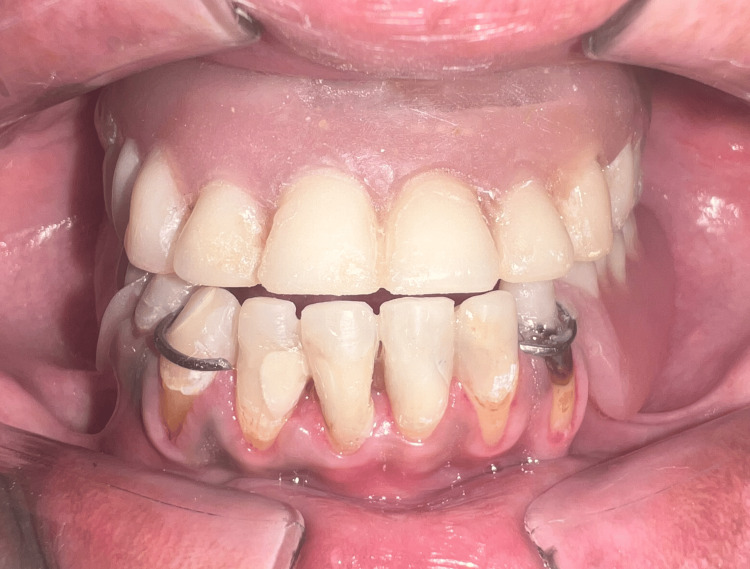 Figure 16