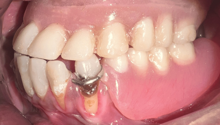 Figure 17