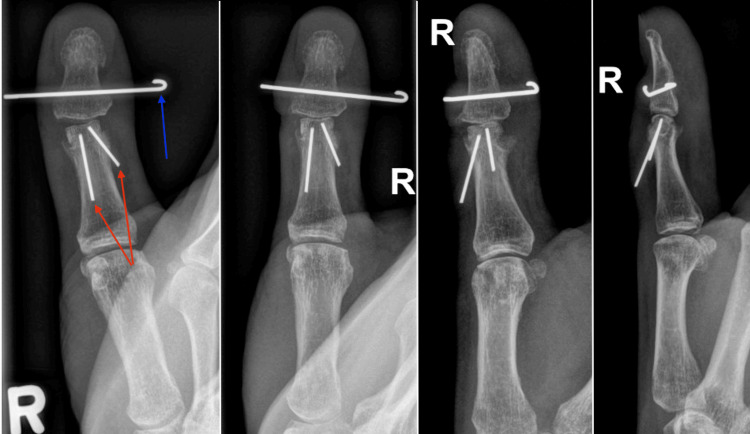 Figure 6