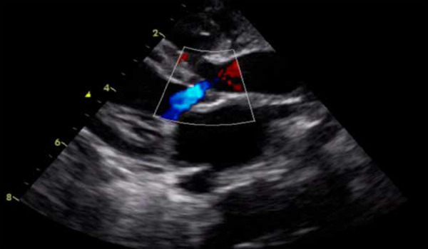 Figure 5